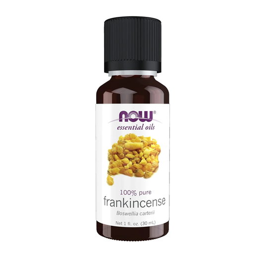 Frankincense Essential Oil, 100% Pure, 1-Ounce